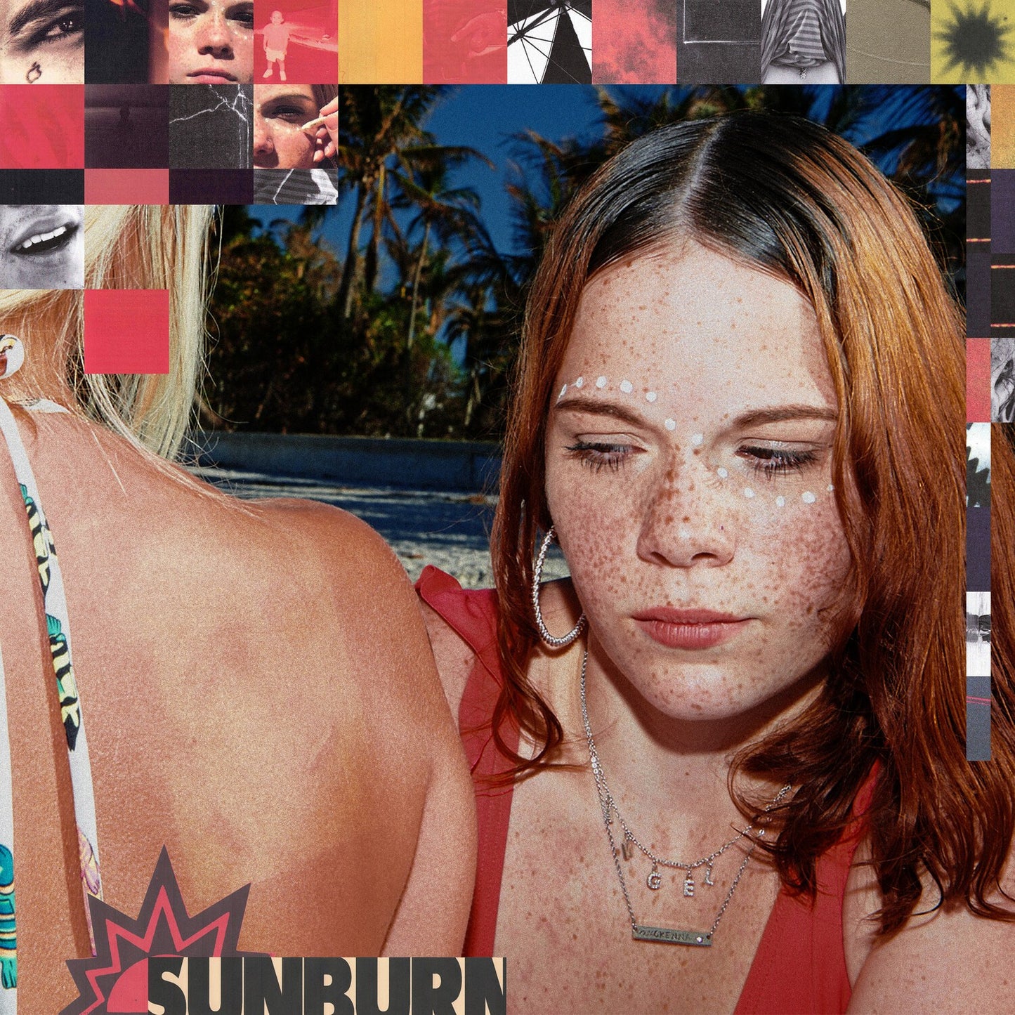Sunburn (X)