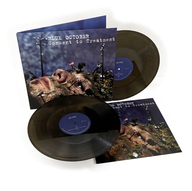 Consent To Treatment (2LP)