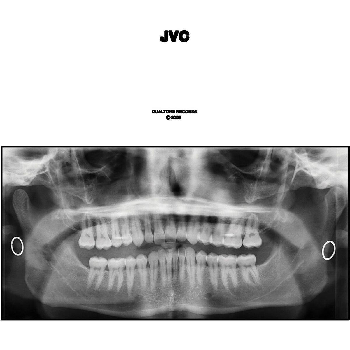 Jvc (2LP)