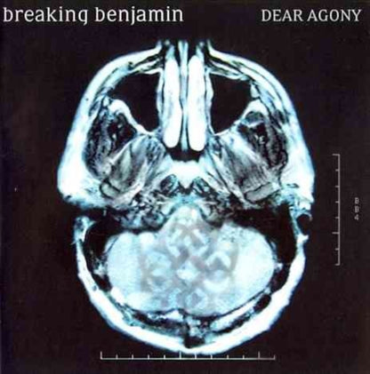 Dear Agony & Phobia