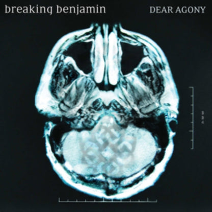 Dark Before Dawn & Dear Agony & Saturate