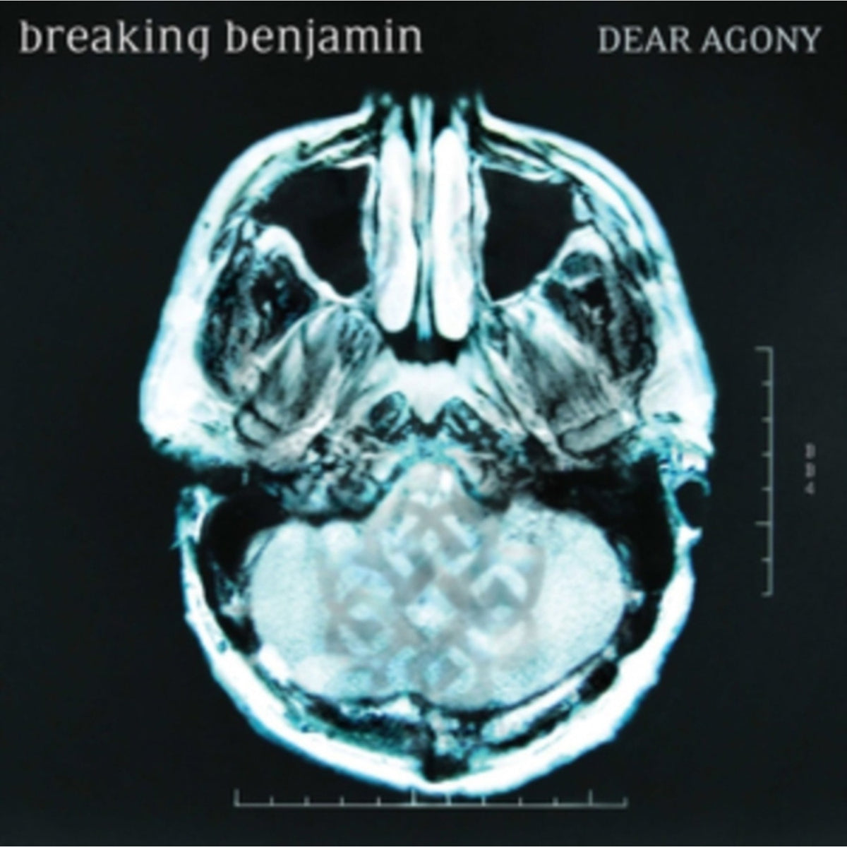 Phobia & Dear Agony