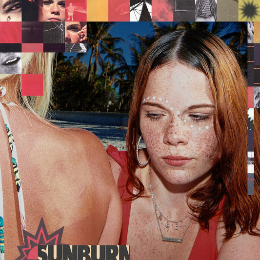 Sunburn (X)