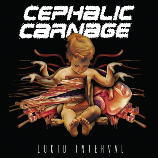 Lucid Interval (Custom Marble LP Vinyl)