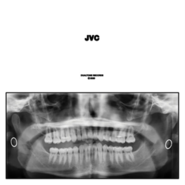 Jvc (2LP)